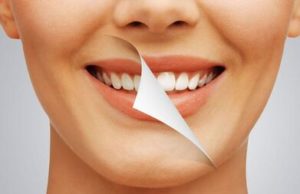 Cosmetic Dentist in El Paso, TX