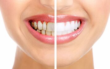 Cosmetic Dentist in El Paso, TX