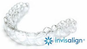 Invisalign in El Paso, TX