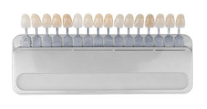 Teeth Whitening in El Paso, TX