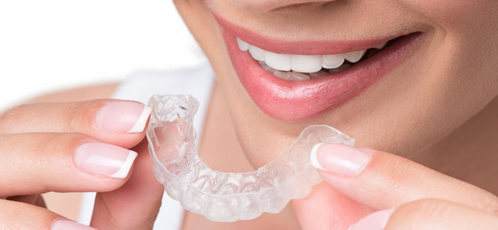Invisalign provider El Paso, TX - The Dentist