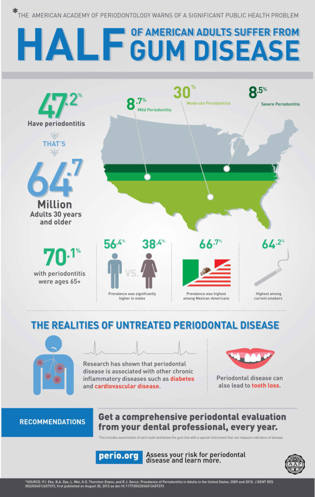 Periodontal Disease - The Dentist El Paso